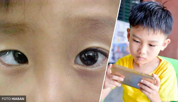 Budak Juling Mata Kanan Akibat Kerap Main Game Di Handphone Ketika Cuti Sekolah Sabah Post